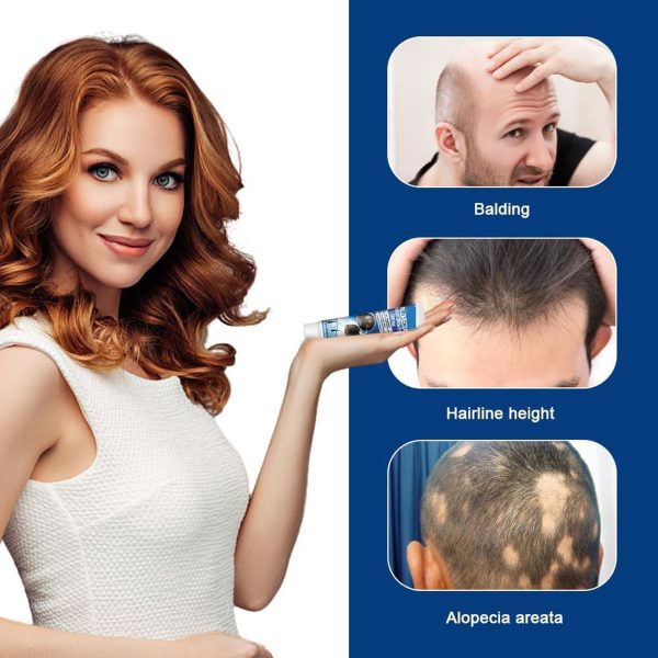 دهان طبيعي لعلاج داء الثعلبة - 20 جرام