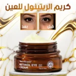 كريم الريتينول للعين لإزالة الإنتفاخات ومكافحة التجاعيد حول منطقة العين - eye cream Retionl