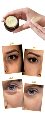 كريم الريتينول للعين لإزالة الإنتفاخات ومكافحة التجاعيد حول منطقة العين - eye cream Retionl2